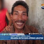 Lahir Tanpa Lubang Anus, Keluarga Butuh Biaya Operasi Lanjutan