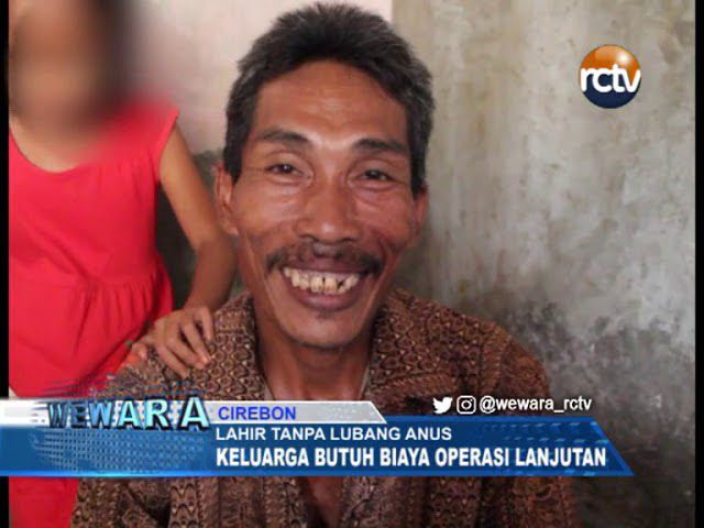 Lahir Tanpa Lubang Anus, Keluarga Butuh Biaya Operasi Lanjutan Lahir Tanpa Lubang Anus, Keluarga Butuh Biaya Operasi Lanjutan