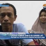 Operasi Kembar Siam Di Rs Gunung Jati, Pertama Kali Dilakukan Di Cirebon