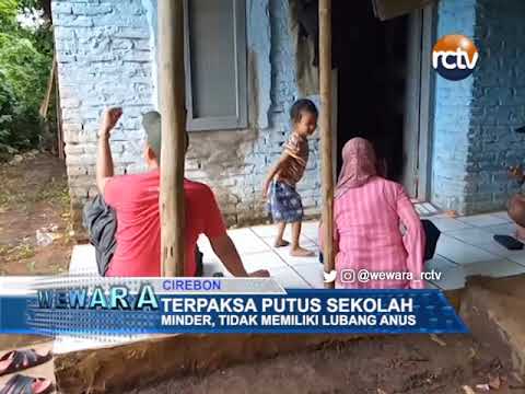 Terpaksa Putus Sekolah, Minder, Tidak Memiliki Lubang Anus