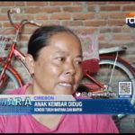 Anak Kembar Diduga Alami Gizi Buruk