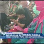 9 Anak Jalani Operasi Bibir Sumbing