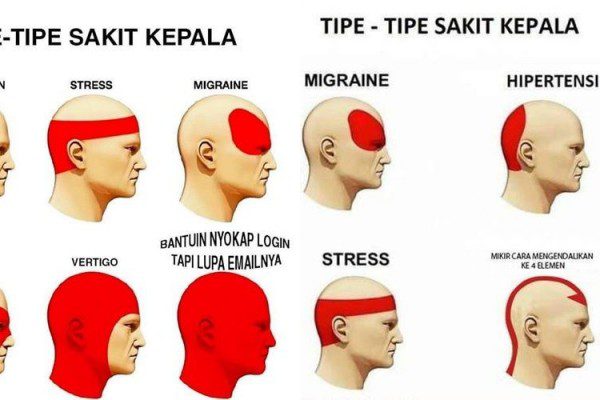 3 tipe sakit kepala dan cara mengobati nya,kamu tipe yang mana nih ?!