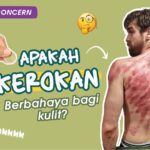 Bukan Hanya Mitos Tapi Fakta , 6 Manpaat Kerokan Bagi Tubuh,Yuk Simak Apa Saja Manpaat Nya !