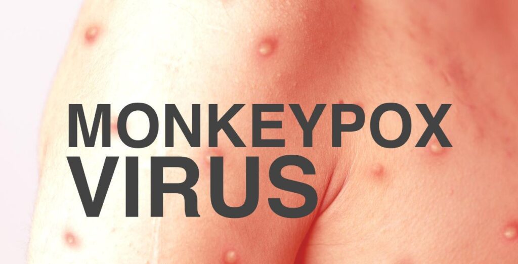 monkeypox virus