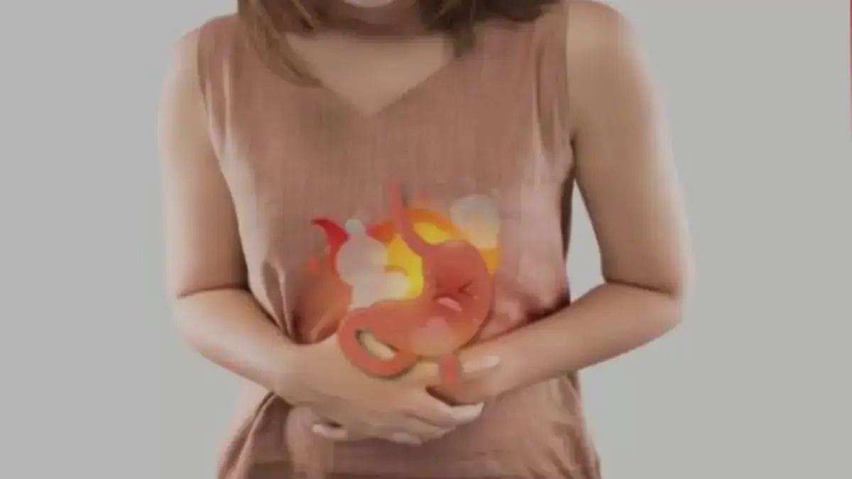 Penyakit Asam Lambung