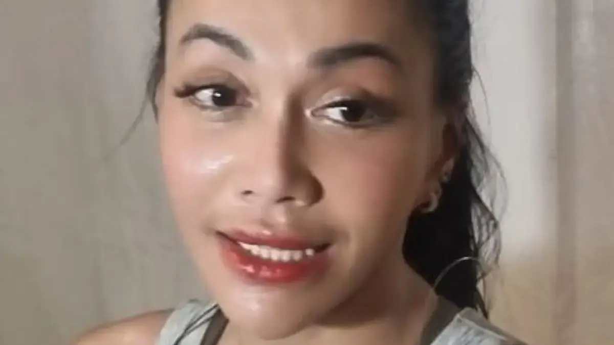 Denada Jalani Operasi Hidung Diam-Diam, Ini Alasan Tak Beritahu Sang Anak
