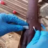 wabah Mpox