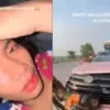 lusyana jelita kecelakaan di tol sragen/foto:canva.com