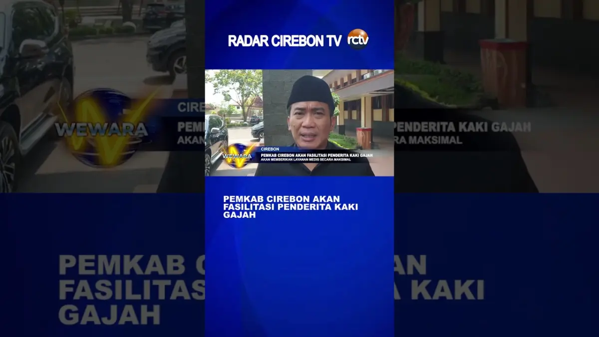 Pemkab Cirebon Akan Fasilitasi Penderita Kaki Gajah