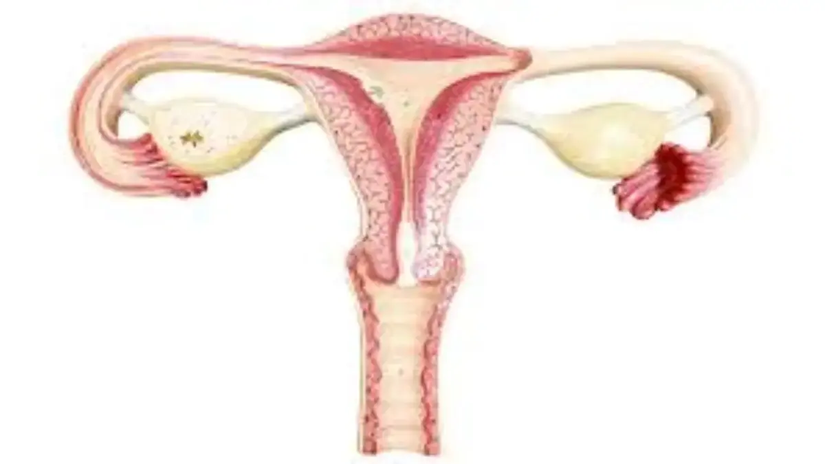 Menurut Dr Zaidul Akbar, Cara Mencegah Penyakit Kista Ovarium cegah penyakit kista. Foto: halodoc.com